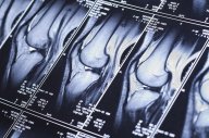 МРТ-исследование суставов: показания, противопоказания и стоимость