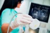 УЗИ сосудов: ваш надежный щит от инсульта