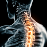 Защемление нерва в шее