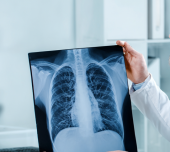 КТ-диагностика заболеваний легких: от пневмонии до опухолей