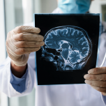 Черепно-мозговые травмы и МРТ