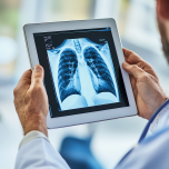 КТ в диагностике респираторных заболеваний и пневмонии: почему это важно?