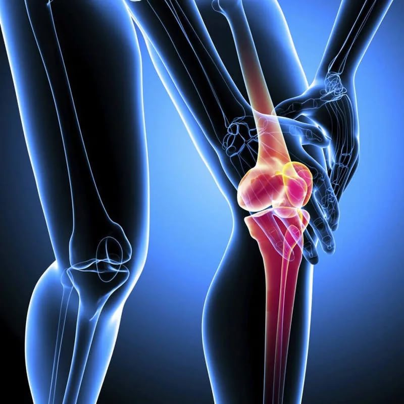 Артрит суставов – причины возникновения и методы лечения. Картинка 3