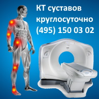 Компьютерная томография суставов