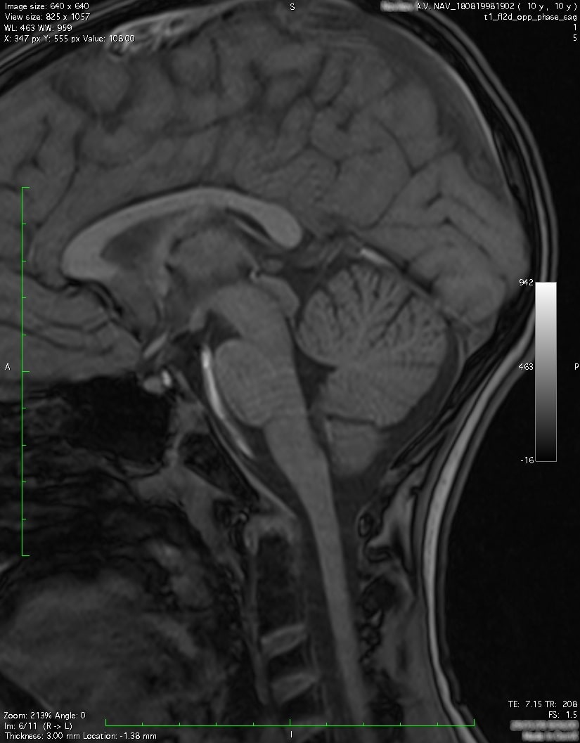 Головной мозг на МРТ - Лечебно-диагностический центр