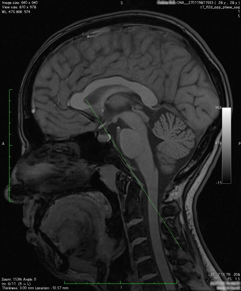 Головной мозг на МРТ - Лечебно-диагностический центр